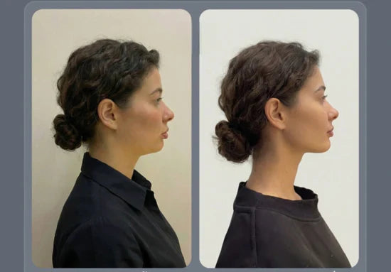 Oferta Especial: Faja Facial Reafirmante – Define y Moldea tu Rostro